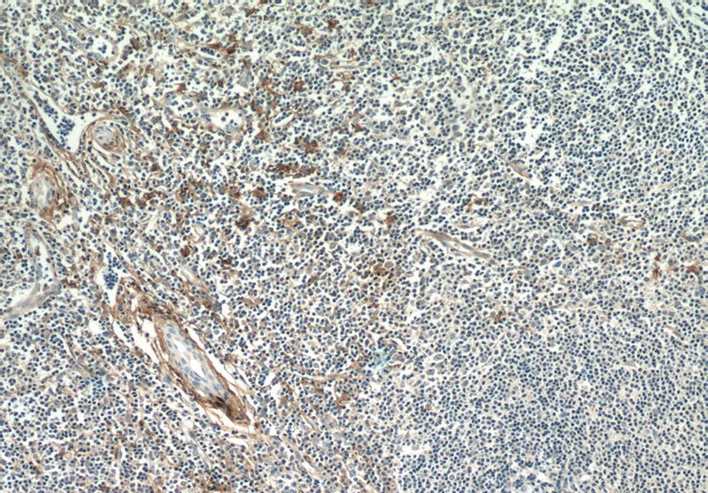 Immunohistochemistry of paraffin-embedded human tonsillitis tissue slide using (ANPEP Antibody) at dilution of 1:100 (under 10x lens)