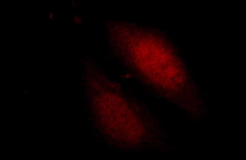 Immunofluorescent analysis of HepG2 cells, using PITX1 antibody Catalog No:113840 at 1:25 dilution and Rhodamine-labeled goat anti-rabbit IgG (red).