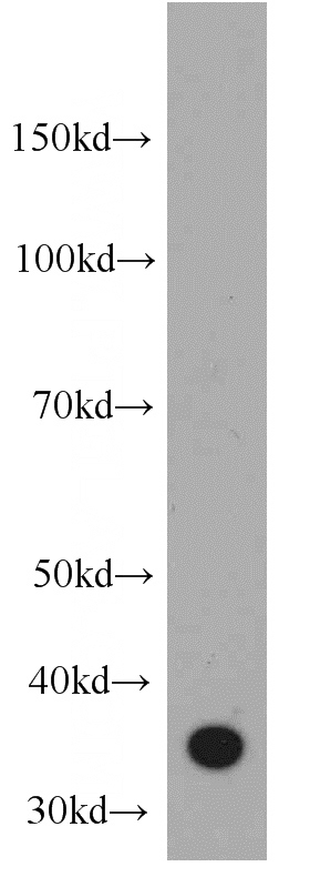 human spleen tissue were subjected to SDS PAGE followed by western blot with Catalog No:109029(CD336 antibody) at dilution of 1:500