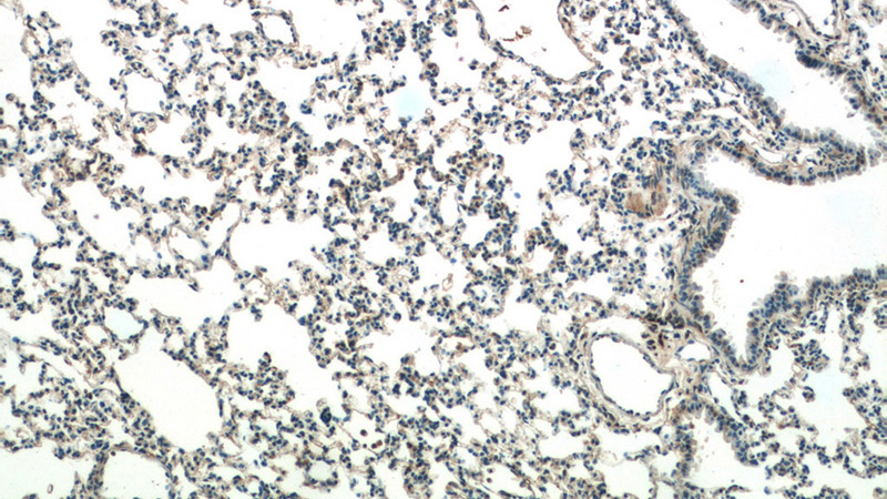 Immunohistochemistry of paraffin-embedded mouse lung tissue slide using Catalog No:110428(F2RL3 Antibody) at dilution of 1:50 (under 10x lens)
