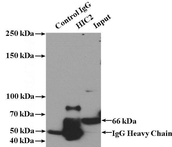 IP Result of anti-HIC2 (IP:Catalog No:111343, 4ug; Detection:Catalog No:111343 1:300) with Jurkat cells lysate 2400ug.