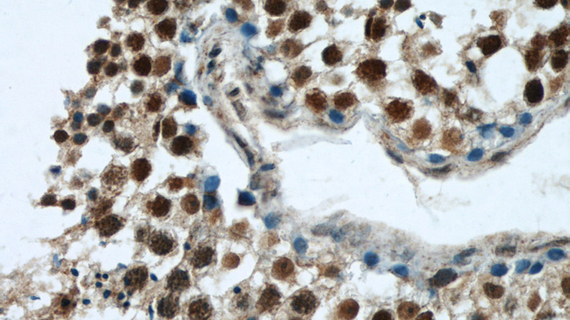 Immunohistochemical of paraffin-embedded human testis using Catalog No:114577(RCC1 antibody) at dilution of 1:50 (under 40x lens)