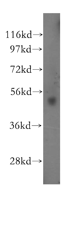 HeLa cells were subjected to SDS PAGE followed by western blot with Catalog No:114469(RARG antibody) at dilution of 1:400