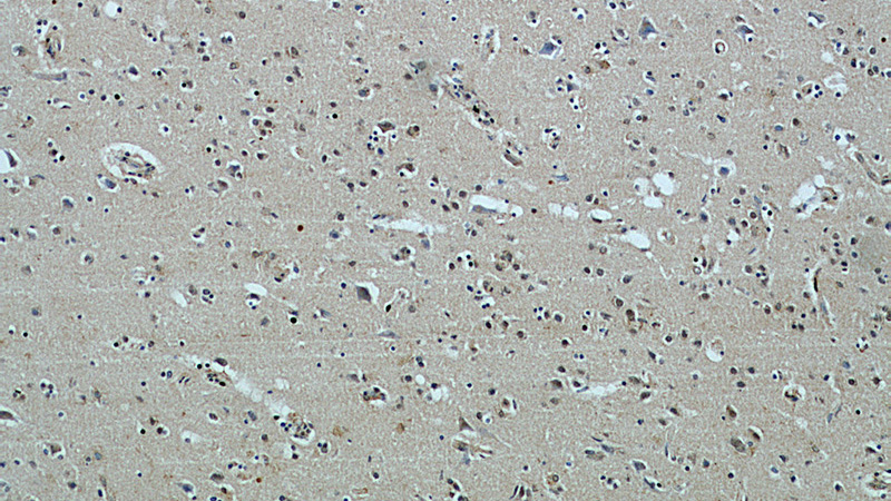 Immunohistochemical of paraffin-embedded human brain using Catalog No:113120(NeuN antibody) at dilution of 1:50 (under 10x lens)