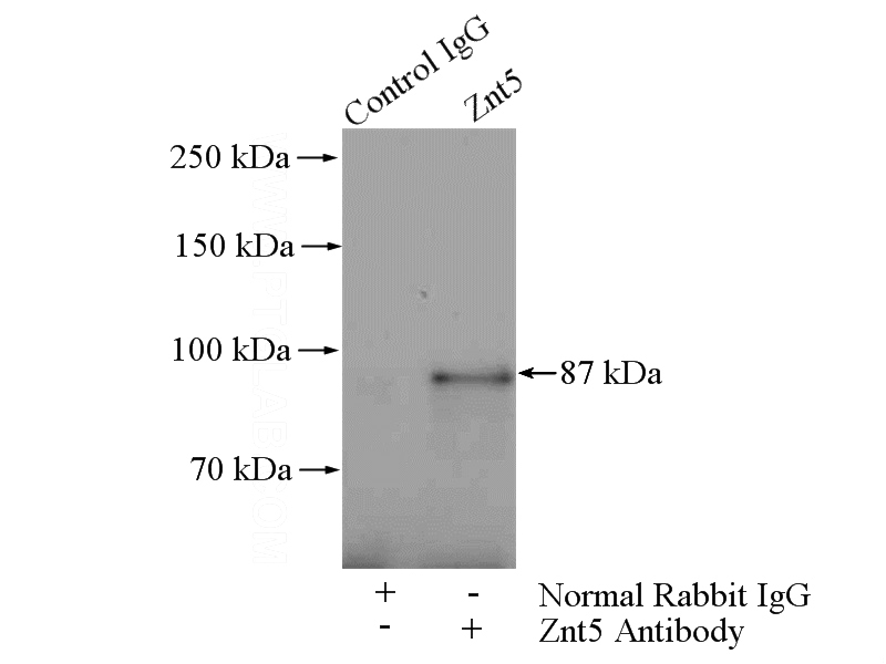 IP Result of anti-SLC30A5 (IP:Catalog No:117257, 4ug; Detection:Catalog No:117257 1:500) with mouse liver tissue lysate 4000ug.