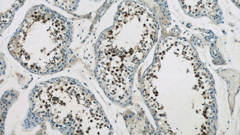 Immunohistochemistry of paraffin-embedded human testis tissue slide using Catalog No:116565(UIMC1 Antibody) at dilution of 1:50 (under 10x lens)