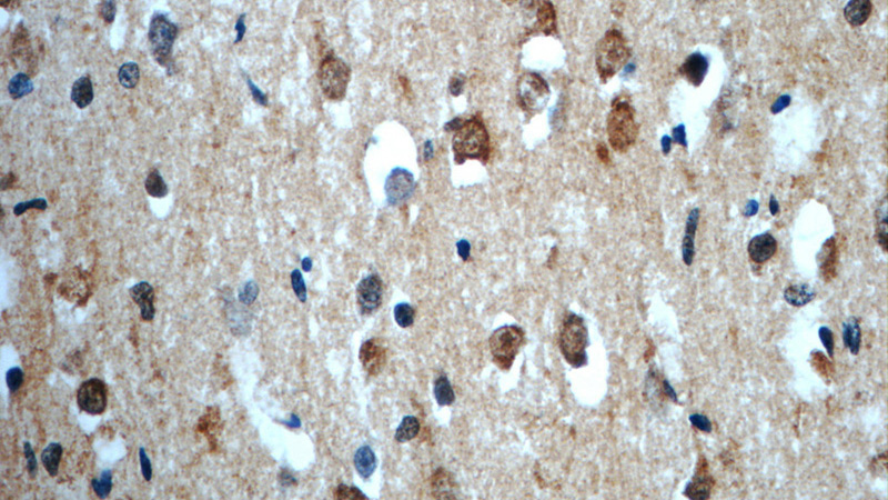 Immunohistochemistry of paraffin-embedded human brain slide using Catalog No:115455(SNRNP48 Antibody) at dilution of 1:50
