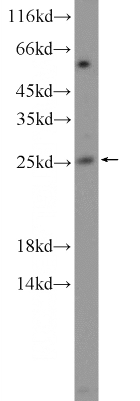 mouse kidney tissue were subjected to SDS PAGE followed by western blot with Catalog No:113253(NMNAT3 Antibody) at dilution of 1:300