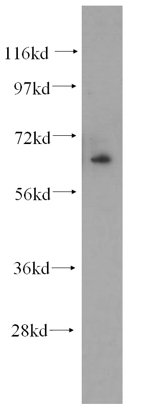 mouse skeletal muscle tissue were subjected to SDS PAGE followed by western blot with Catalog No:113146(NFE2L1 antibody) at dilution of 1:500