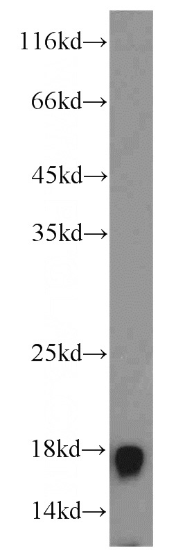 MCF7 cells were subjected to SDS PAGE followed by western blot with Catalog No:117326(Histone-H3 antibody) at dilution of 1:1000