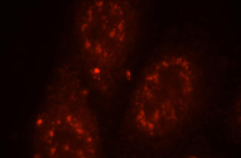 Immunofluorescent analysis of HepG2 cells, using PNN antibody Catalog No:113909 at 1:25 dilution and Rhodamine-labeled goat anti-rabbit IgG (red).