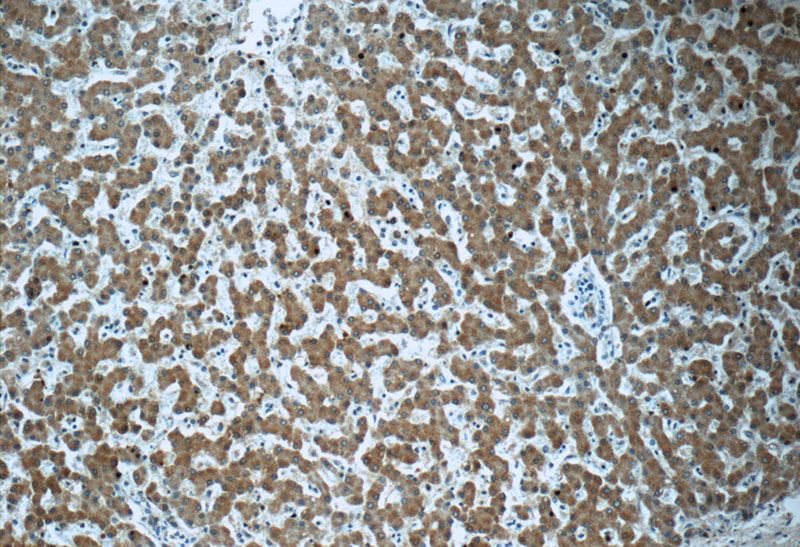 Immunohistochemistry of paraffin-embedded human liver tissue slide using Catalog No:116903(ZAK Antibody) at dilution of 1:50(under 10x lens)