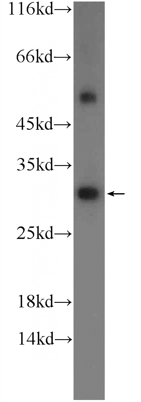 mouse skeletal muscle tissue were subjected to SDS PAGE followed by western blot with Catalog No:115185(SH3BGR Antibody) at dilution of 1:1000