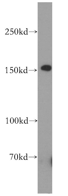 A549 cells were subjected to SDS PAGE followed by western blot with Catalog No:110348(EPHA1-special antibody) at dilution of 1:800