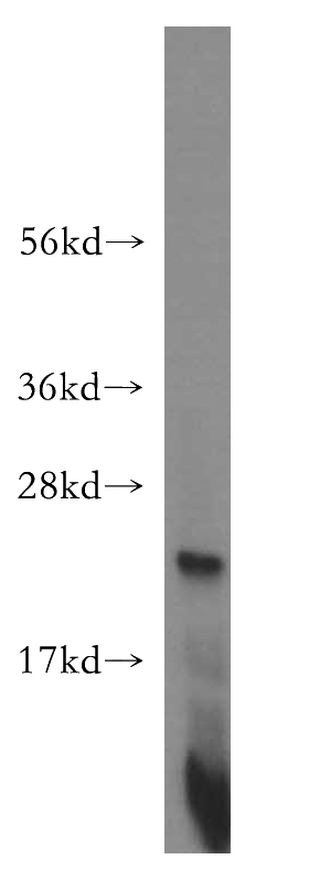 human heart tissue were subjected to SDS PAGE followed by western blot with Catalog No:112817(MRPL21 antibody) at dilution of 1:500