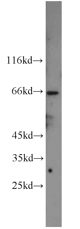 HeLa cells were subjected to SDS PAGE followed by western blot with Catalog No:113451(NXF1 antibody) at dilution of 1:600
