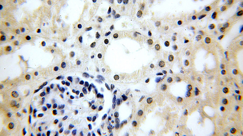 Immunohistochemical of paraffin-embedded human kidney using Catalog No:109528(CPSF6 antibody) at dilution of 1:50 (under 40x lens)