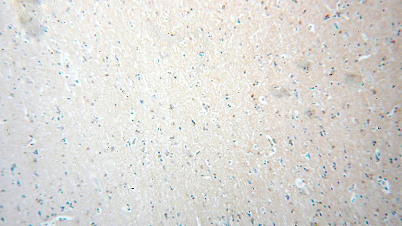 Immunohistochemical of paraffin-embedded human brain using Catalog No:110463(FAM118B antibody) at dilution of 1:100 (under 10x lens)