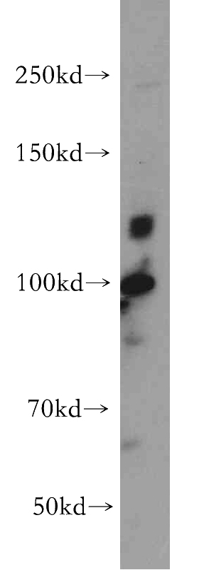 PC-3 cells were subjected to SDS PAGE followed by western blot with Catalog No:110289(CDH1-Specific antibody) at dilution of 1:500