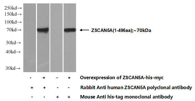 Transfected HEK-293 cells were subjected to SDS PAGE followed by western blot with Catalog No:117268(ZSCAN5A Antibody) at dilution of 1:1000