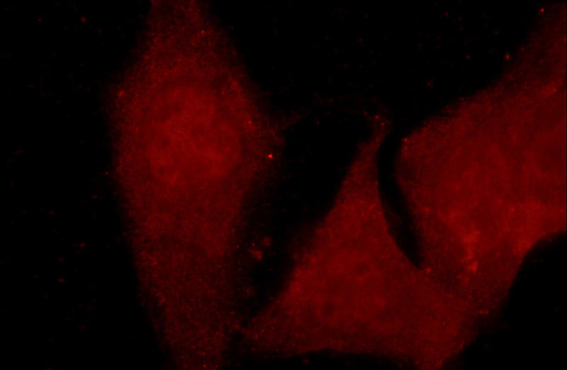 Immunofluorescent analysis of MCF-7 cells using Catalog No:108192(ARID4B Antibody) at dilution of 1:25 and Rhodamine-Goat anti-Rabbit IgG