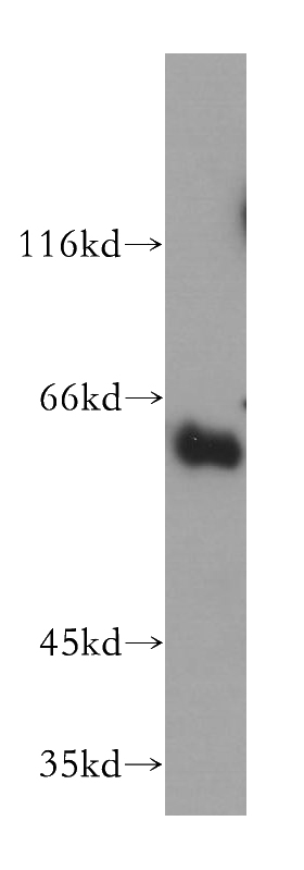 mouse thymus tissue were subjected to SDS PAGE followed by western blot with Catalog No:115775(SYT3 antibody) at dilution of 1:300