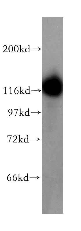 human brain tissue were subjected to SDS PAGE followed by western blot with Catalog No:116470(UBA6 antibody) at dilution of 1:800