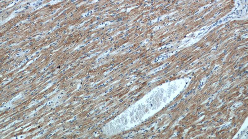 Immunohistochemical of paraffin-embedded human heart using Catalog No:112106(KLHL35 antibody) at dilution of 1:100 (under 10x lens)