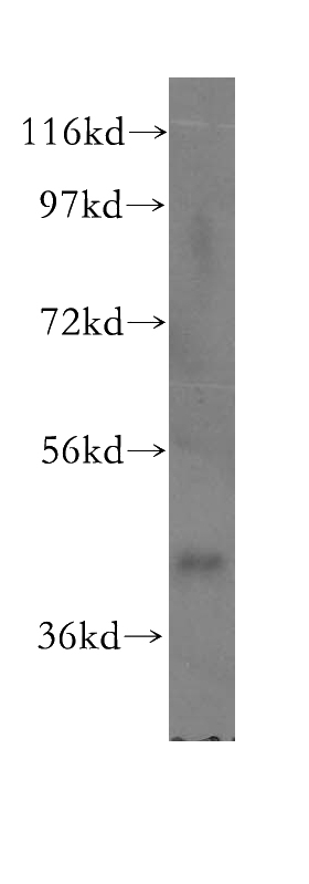 Jurkat cells were subjected to SDS PAGE followed by western blot with Catalog No:111023(GLI4 antibody) at dilution of 1:300