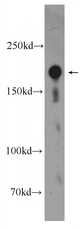 human testis tissue were subjected to SDS PAGE followed by western blot with Catalog No:114747(RNF17 Antibody) at dilution of 1:600