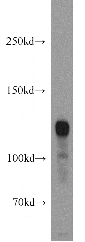 human brain tissue were subjected to SDS PAGE followed by western blot with Catalog No:113661(PDE4A antibody) at dilution of 1:1000