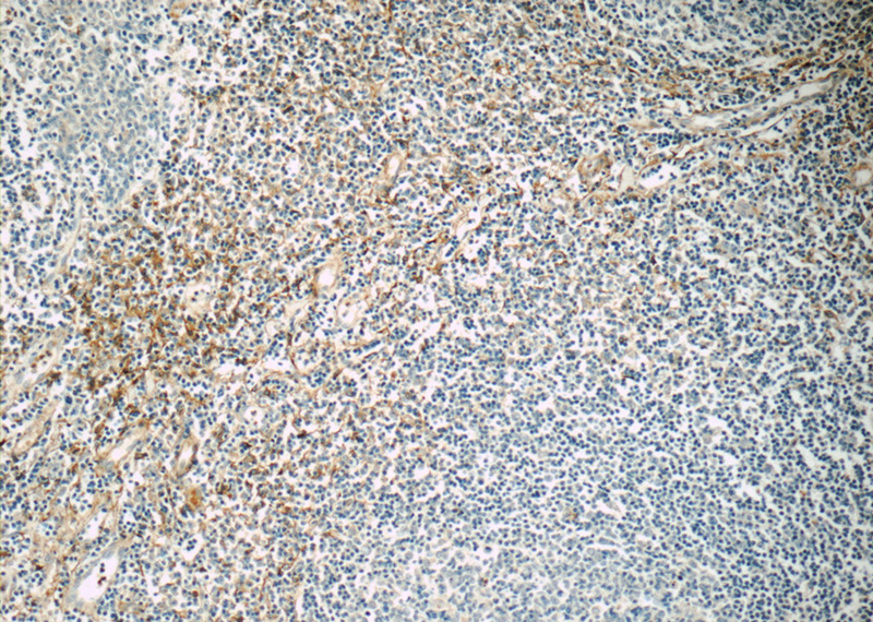 Immunohistochemistry of paraffin-embedded human tonsillitis slide using Catalog No:110320(ENOX1 Antibody) at dilution of 1:50