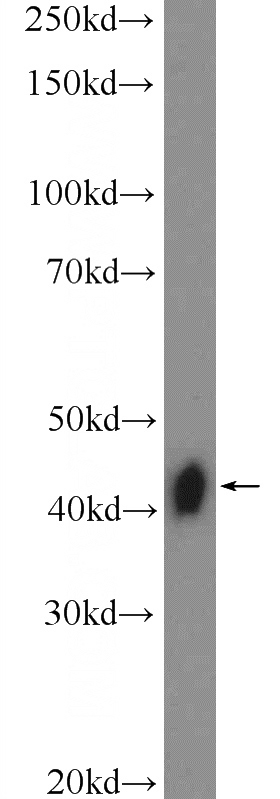 L02 cells were subjected to SDS PAGE followed by western blot with Catalog No:116991(XPA Antibody) at dilution of 1:600