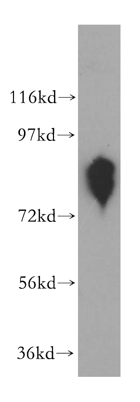 mouse testis tissue were subjected to SDS PAGE followed by western blot with Catalog No:115943(ANTXR1 antibody) at dilution of 1:200