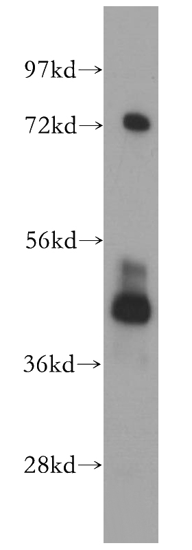 mouse testis tissue were subjected to SDS PAGE followed by western blot with Catalog No:113822(PHKG2 antibody) at dilution of 1:300