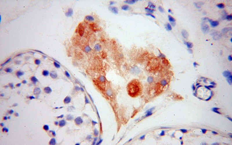 Immunohistochemical of paraffin-embedded human testis using Catalog No:112234(Lin28B-specific antibody) at dilution of 1:50 (under 40x lens)