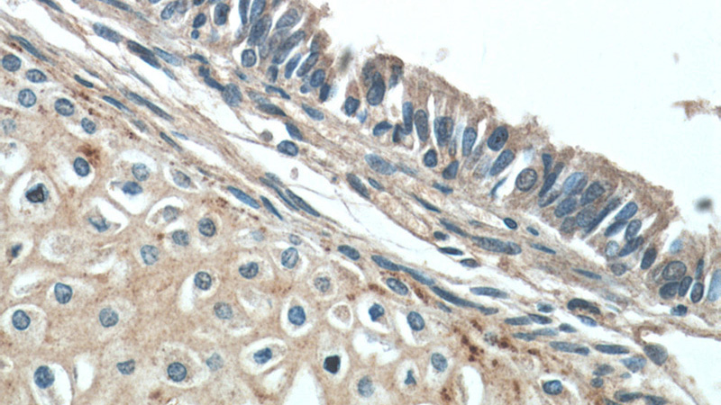 Immunohistochemical of paraffin-embedded human lung using Catalog No:107425(MGP antibody) at dilution of 1:50 (under 40x lens)