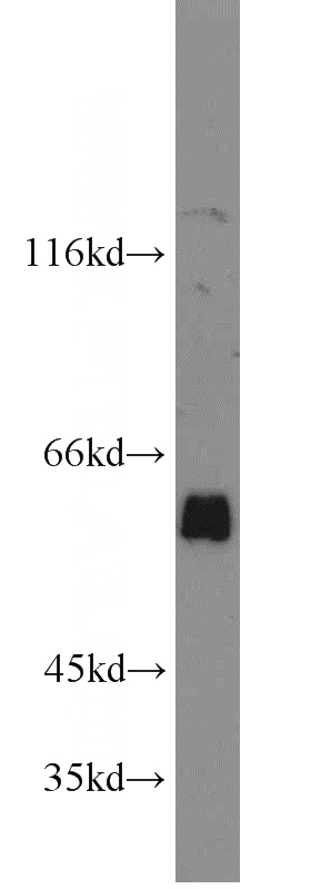 PC-3 cells were subjected to SDS PAGE followed by western blot with Catalog No:107738(ACPP antibody) at dilution of 1:1000