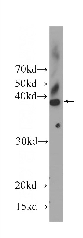 K-562 cells were subjected to SDS PAGE followed by western blot with Catalog No:107147(CDK2 Antibody) at dilution of 1:1000