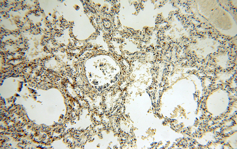 Immunohistochemical of paraffin-embedded human lung using Catalog No:108665(C14orf94 antibody) at dilution of 1:100 (under 10x lens)