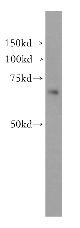 Jurkat cells were subjected to SDS PAGE followed by western blot with Catalog No:112090(KLHL13 antibody) at dilution of 1:500