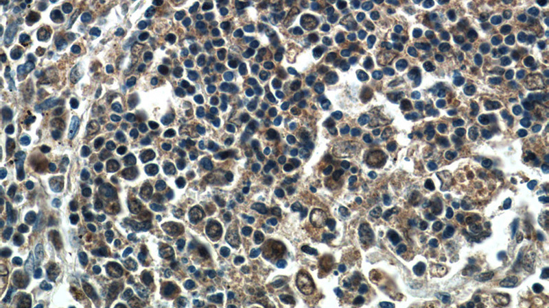 Immunohistochemistry of paraffin-embedded human spleen tissue slide using Catalog No:107937(AKNA Antibody) at dilution of 1:25 (under 40x lens)