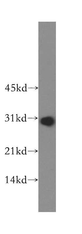 HepG2 cells were subjected to SDS PAGE followed by western blot with Catalog No:114901(RPL7L1 antibody) at dilution of 1:1000