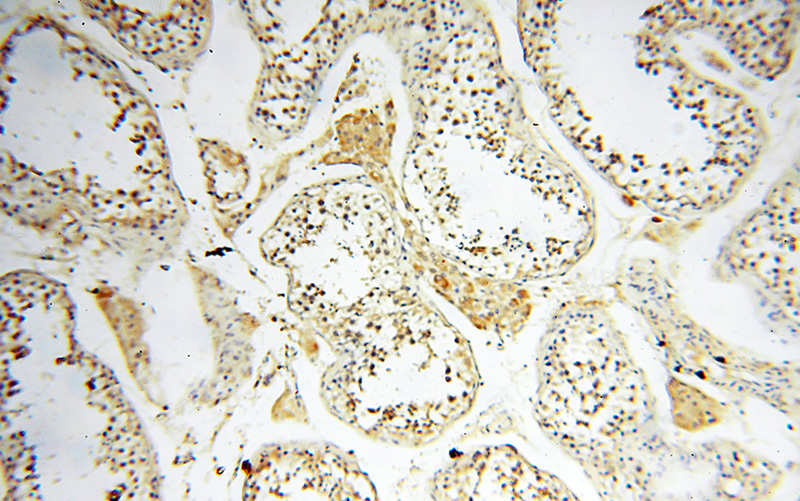 Immunohistochemical of paraffin-embedded human testis using Catalog No:107932(AKAP3 antibody) at dilution of 1:100 (under 10x lens)