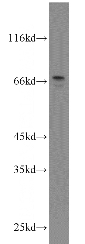 SKOV-3 cells were subjected to SDS PAGE followed by western blot with Catalog No:112918(MYCN antibody) at dilution of 1:1000