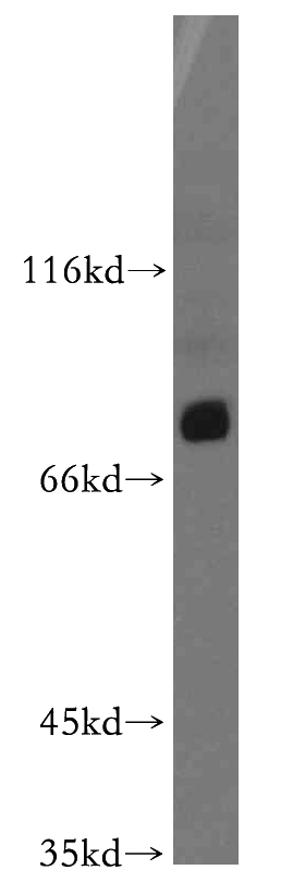 MCF-7 cells were subjected to SDS PAGE followed by western blot with Catalog No:108274(C12orf11 antibody) at dilution of 1:4000