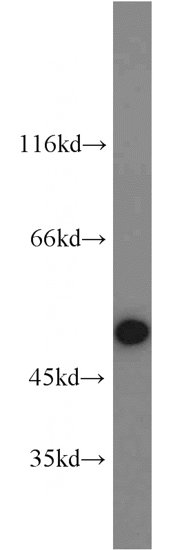 Raji cells were subjected to SDS PAGE followed by western blot with Catalog No:114605(RBM22 antibody) at dilution of 1:1000