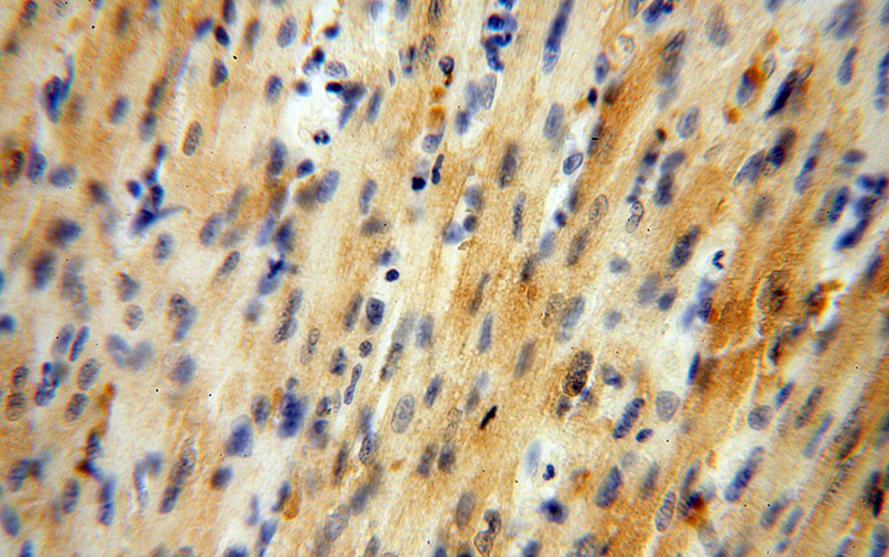 Immunohistochemical of paraffin-embedded human heart using Catalog No:110844(GALM antibody) at dilution of 1:50 (under 40x lens)