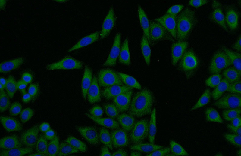Immunofluorescent analysis of HeLa cells using Catalog No:110890(GBF1 Antibody) at dilution of 1:25 and Alexa Fluor 488-congugated AffiniPure Goat Anti-Rabbit IgG(H+L)
