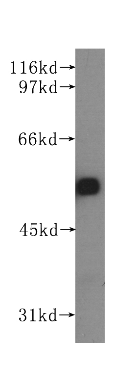 MCF7 cells were subjected to SDS PAGE followed by western blot with Catalog No:107215(FBLN5 antibody) at dilution of 1:500